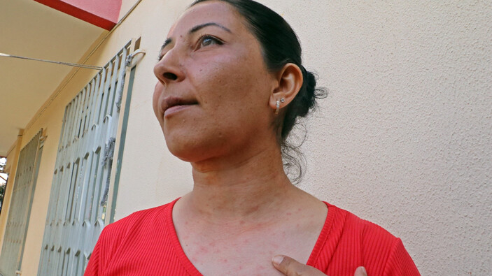 Antalya'da tırtılları süpürdü, hastanelik oldu
